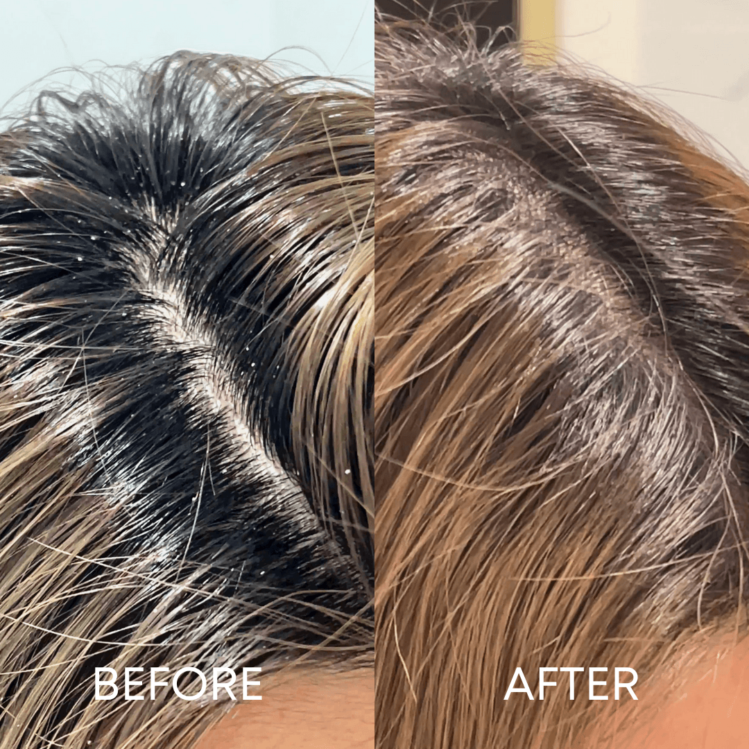 CheekyGlo Scalp Scrubber