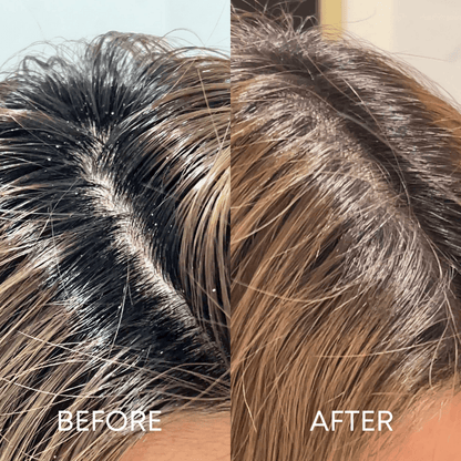 CheekyGlo Scalp Scrubber