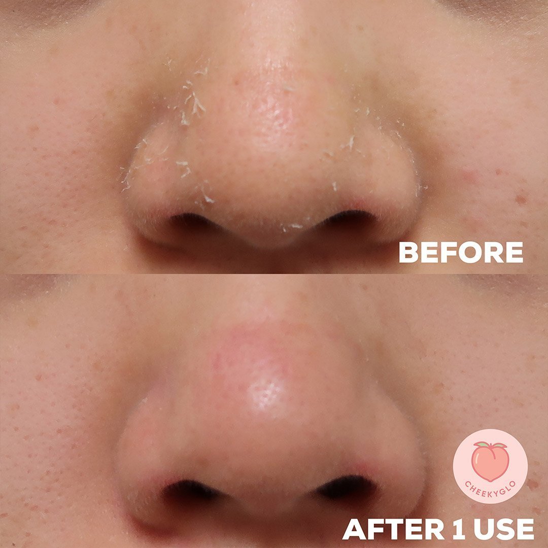 CheekyGlo Silk Exfoliating Face Mitt